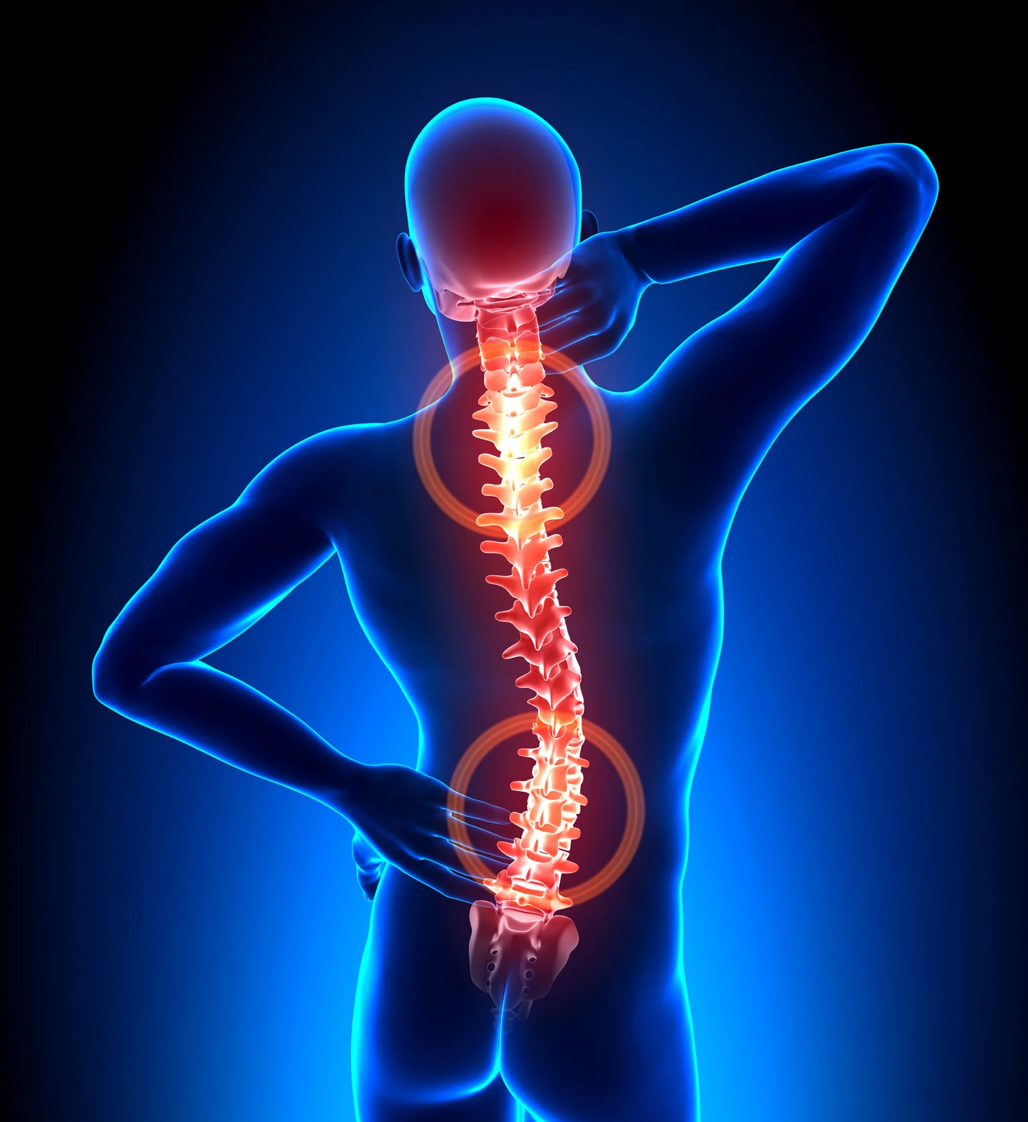 Columna vertebral – Intervencionismo en Dolor